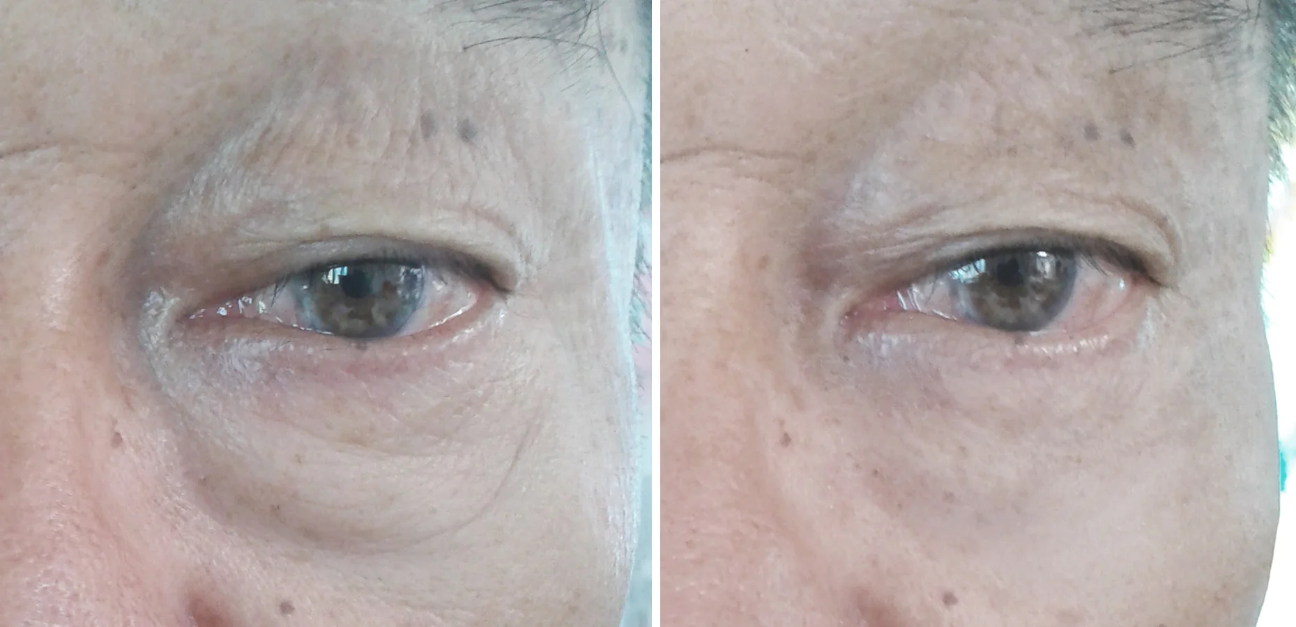 luxury skincare for beautiful younger skin again olaire LY2.1.jpg