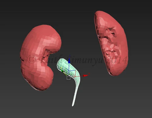retopolgykidney.jpg
