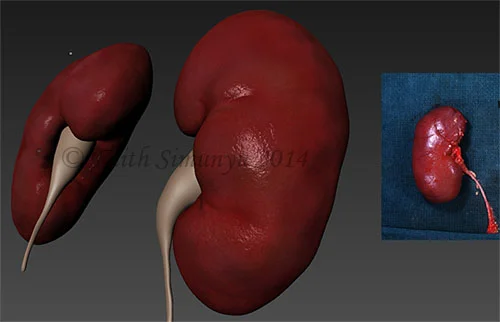 mudboxkidney.jpg