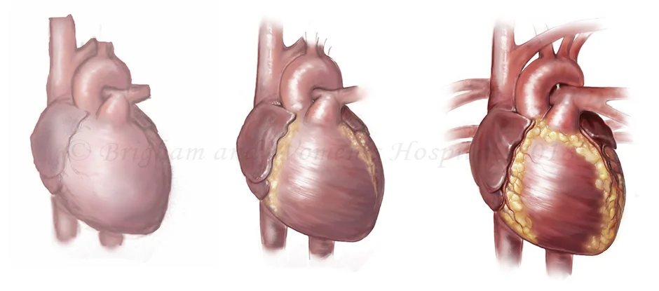 humanHeart.jpg