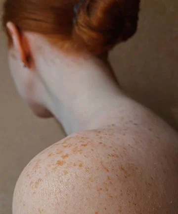 Dry Winter Skin? Here’s How to Fix It and Keep Your Skin Comfortable All Season