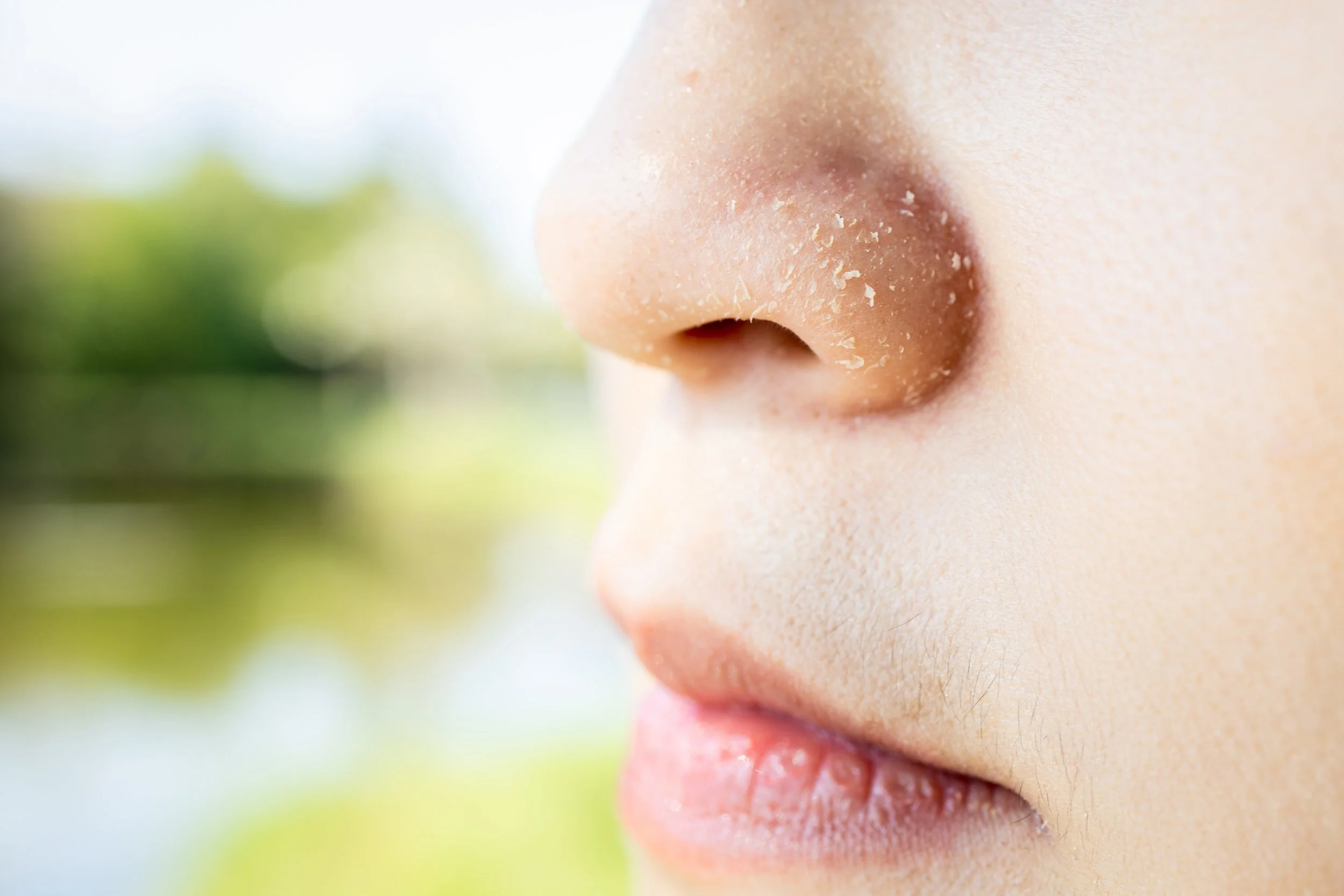 Why Your Skin Still Feels Dry After Moisturizing: Dehydration, Dry Skin, or Barrier Damage?