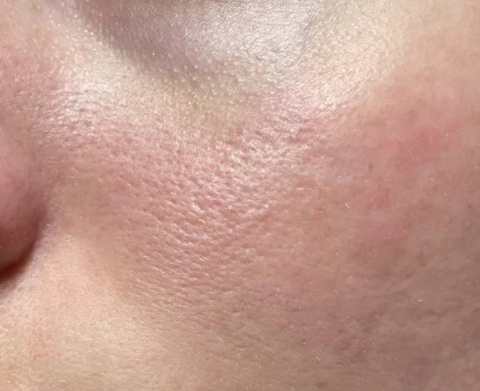 Is Your Skin Barrier Damaged? 4 Signs to Look For and a 14-Day Plan to Fix It