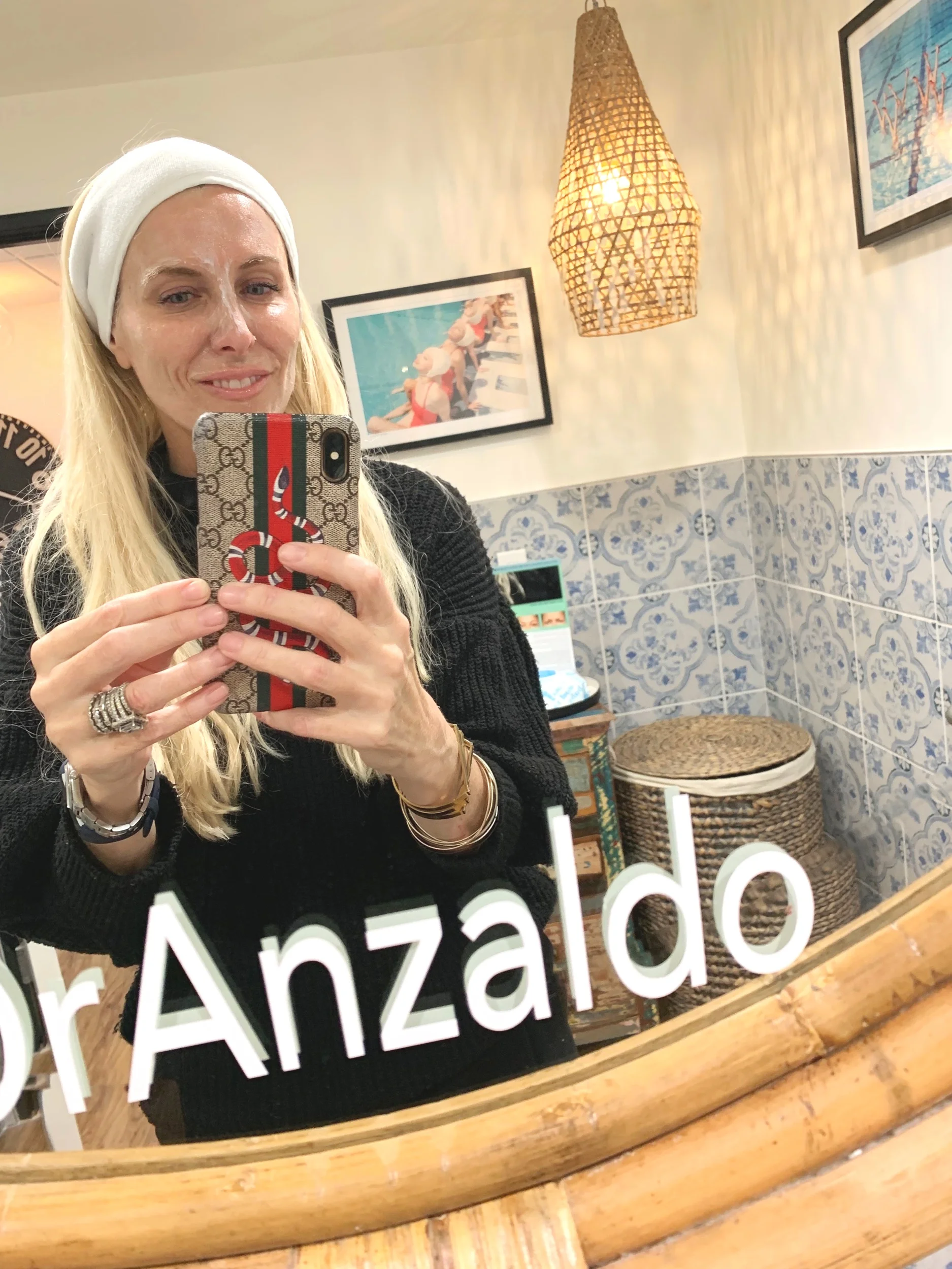 Let me give you some sage advice— listen to your aesthetician, especially if she is manning a laser. Leave the numbing cream on for the ENTIRE recommended time!!