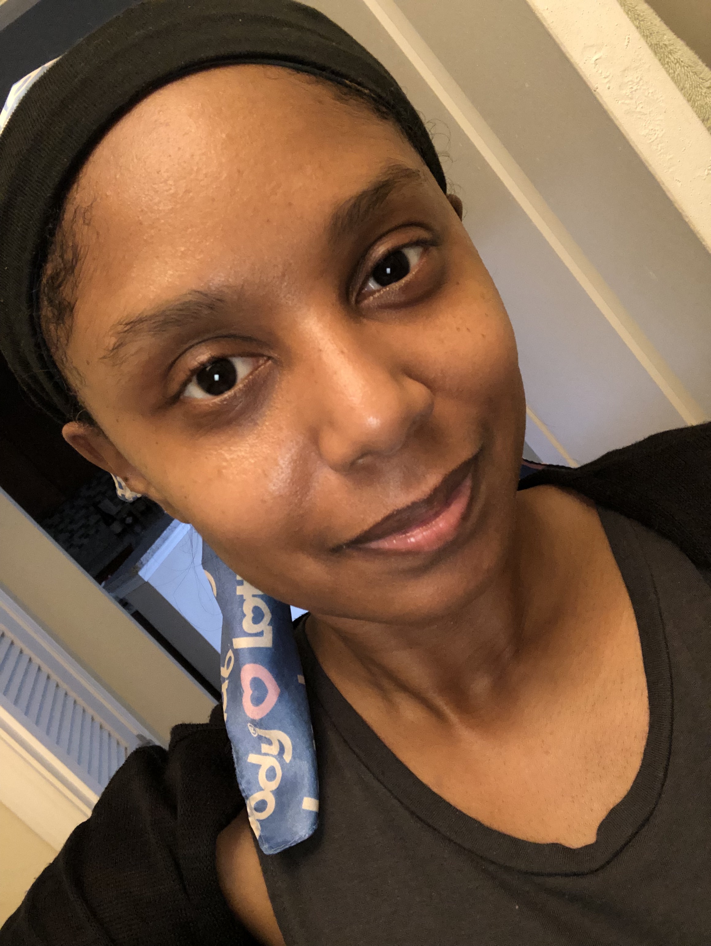 My face after the mask. I feel so rejuvenated!