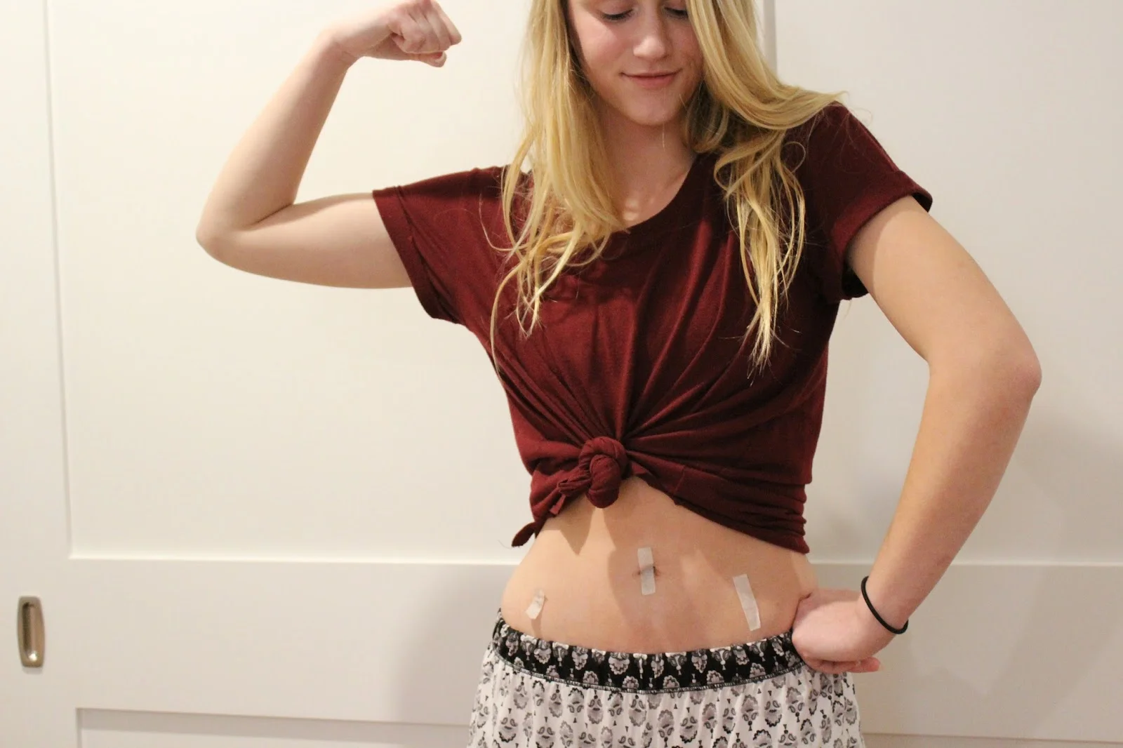 Laura's Story: Endometriosis Awareness Month