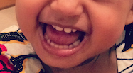 The teeth in question