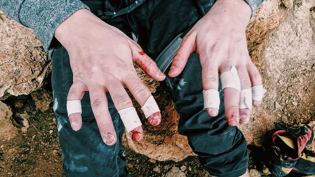 Blood is just finger tears. 