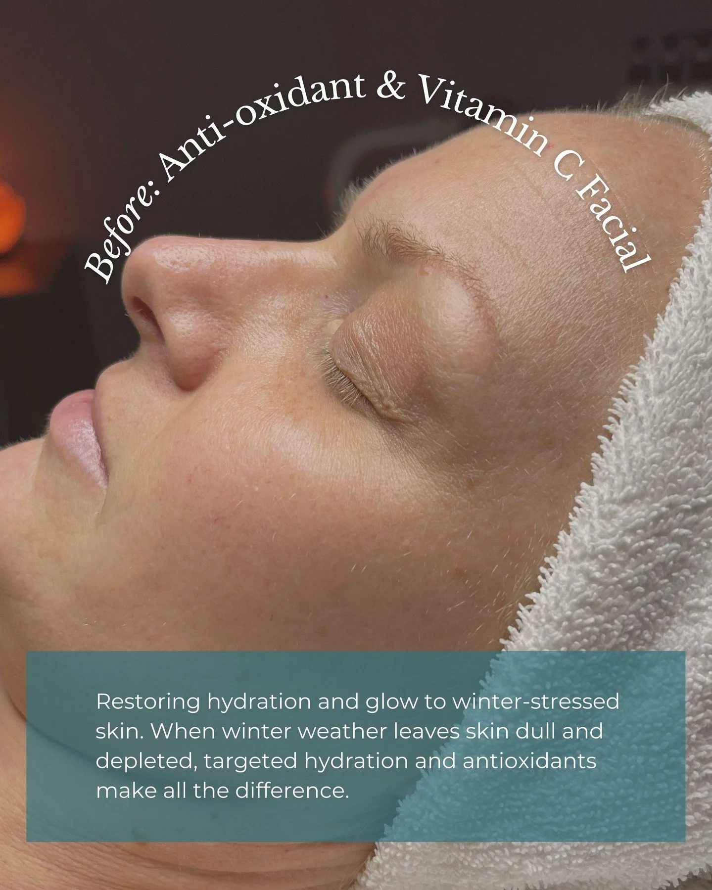 Thunder Bay winters don&rsquo;t play around. ❄️⁠
⁠
The cold, dry air had her skin feeling stripped, dull, and thirsty, so we brought out the heavy hitters. ⁠
⁠
We chose the Antioxidant + Vitamin C Facial to deeply hydrate, brighten, and restore her g
