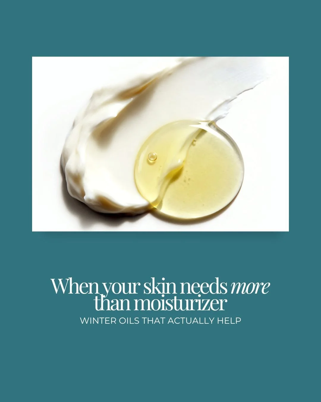 When moisturizer isn&rsquo;t enough, this is what I reach for.⁠
⁠
Winter skin often needs protection as much as hydration. Facial oils help seal moisture in, support the barrier, and restore comfort when skin feels dry, dull, or irritated.⁠
⁠
🩵 55+ 