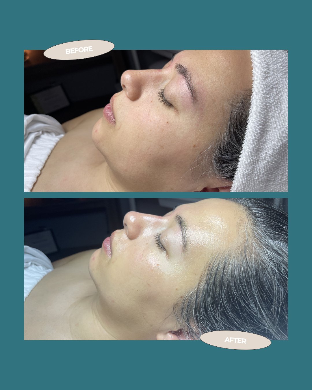 ✨ If your main concern is dull, dehydrated skin but you need something gentle, this is what happens when you book the Ormedic Restoring Facial. ⁠
⁠
Sam is a new mom who came in needing hydration, light exfoliation, and a little self-care time.⁠
⁠
The