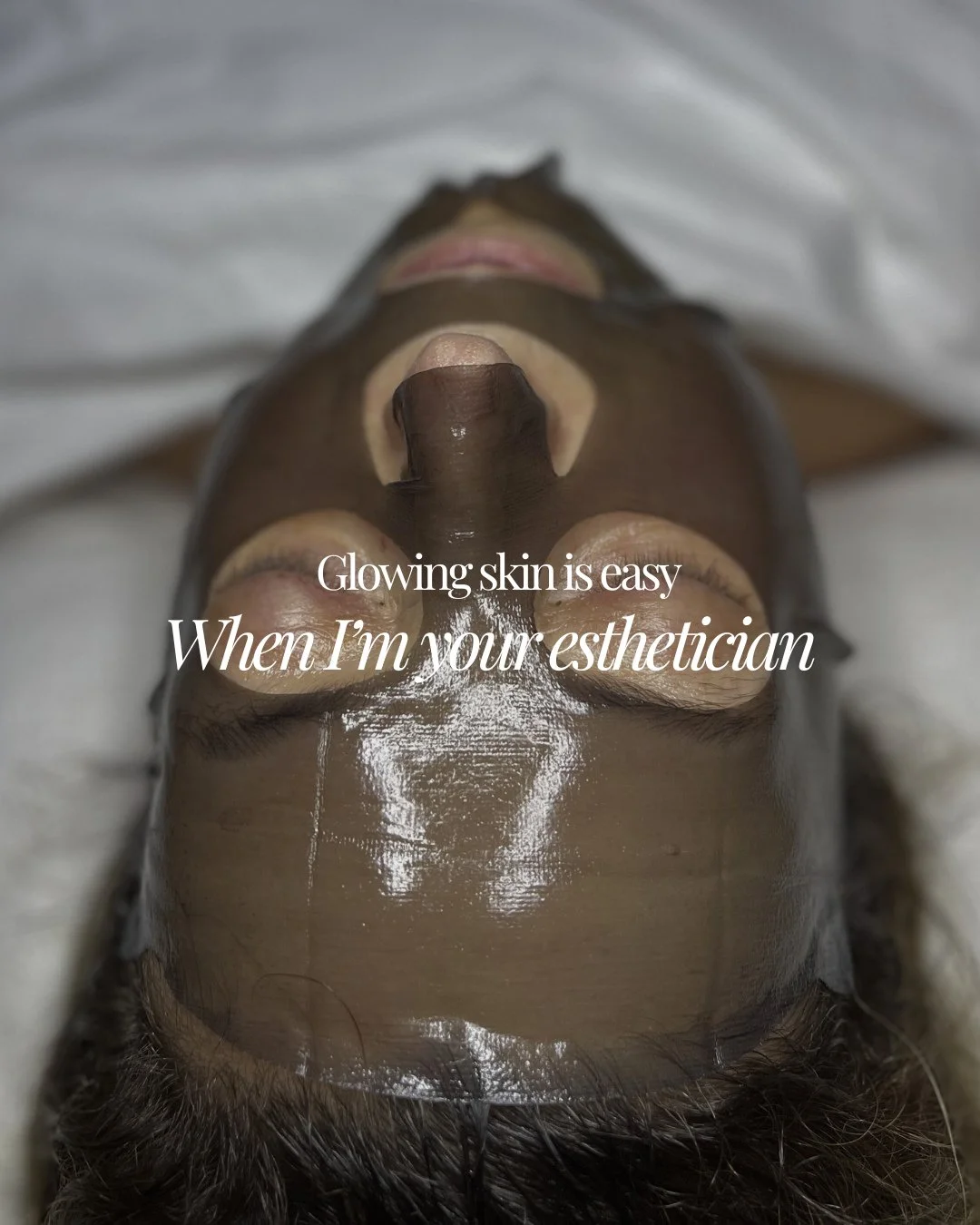 Sheila came in struggling with winter dryness and dehydration, which was making her fine lines appear more noticeable.⁠
⁠
Enter ➡️ retinol support.⁠
⁠
Her treatment plan is a series of the Revitalizing Retinol Lift facial, which helps revitalize the 