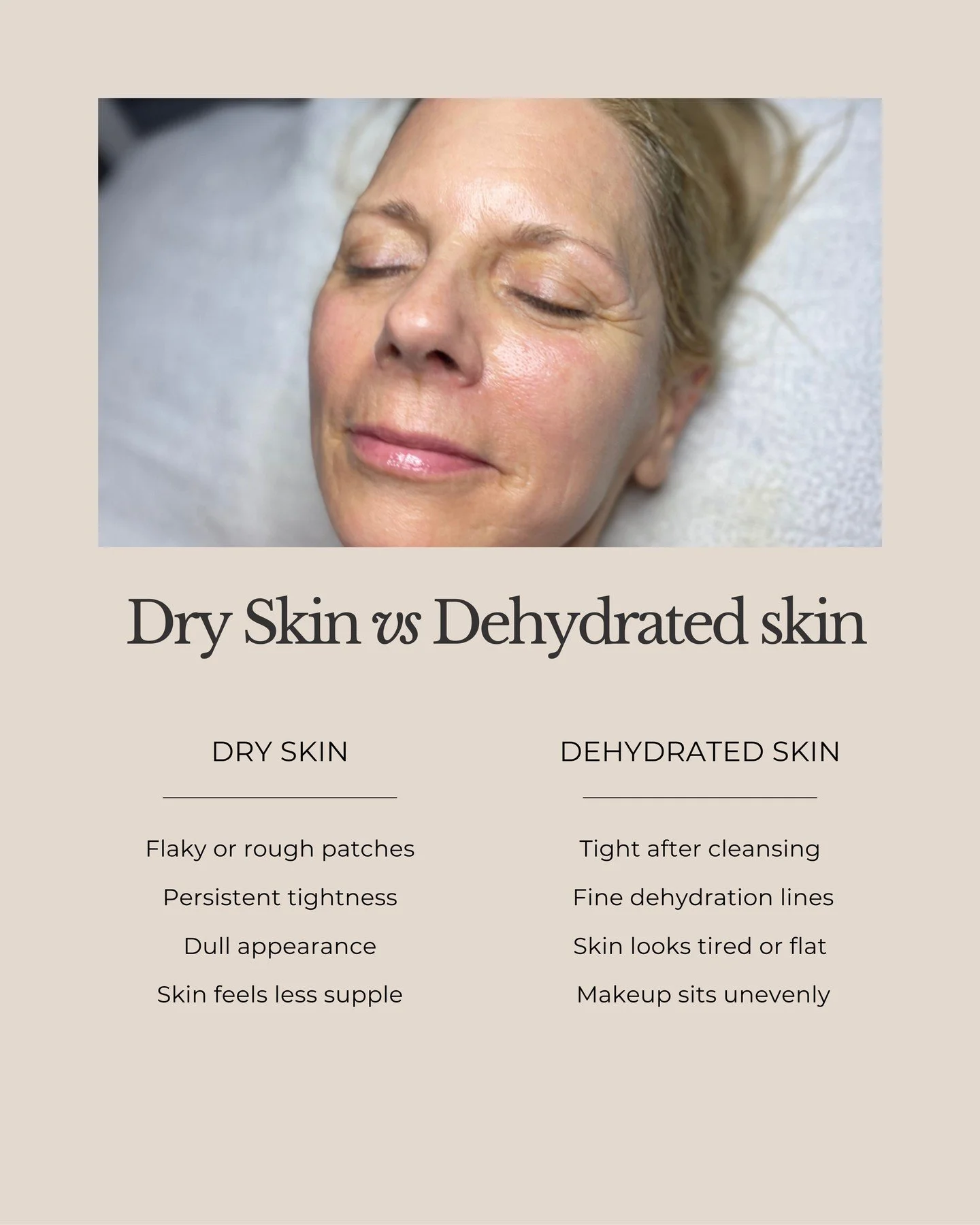 💧Think your skin is dry? It might actually be dehydrated. ⁠
⁠
This is one of the most common mix-ups I see in the treatment room.⁠
⁠
Dry skin is a skin type. It means your skin produces less oil. Dehydrated skin is a condition. It means your skin is