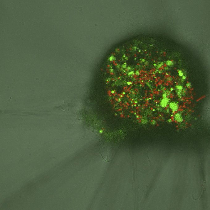 Amoeboid foraminifera 