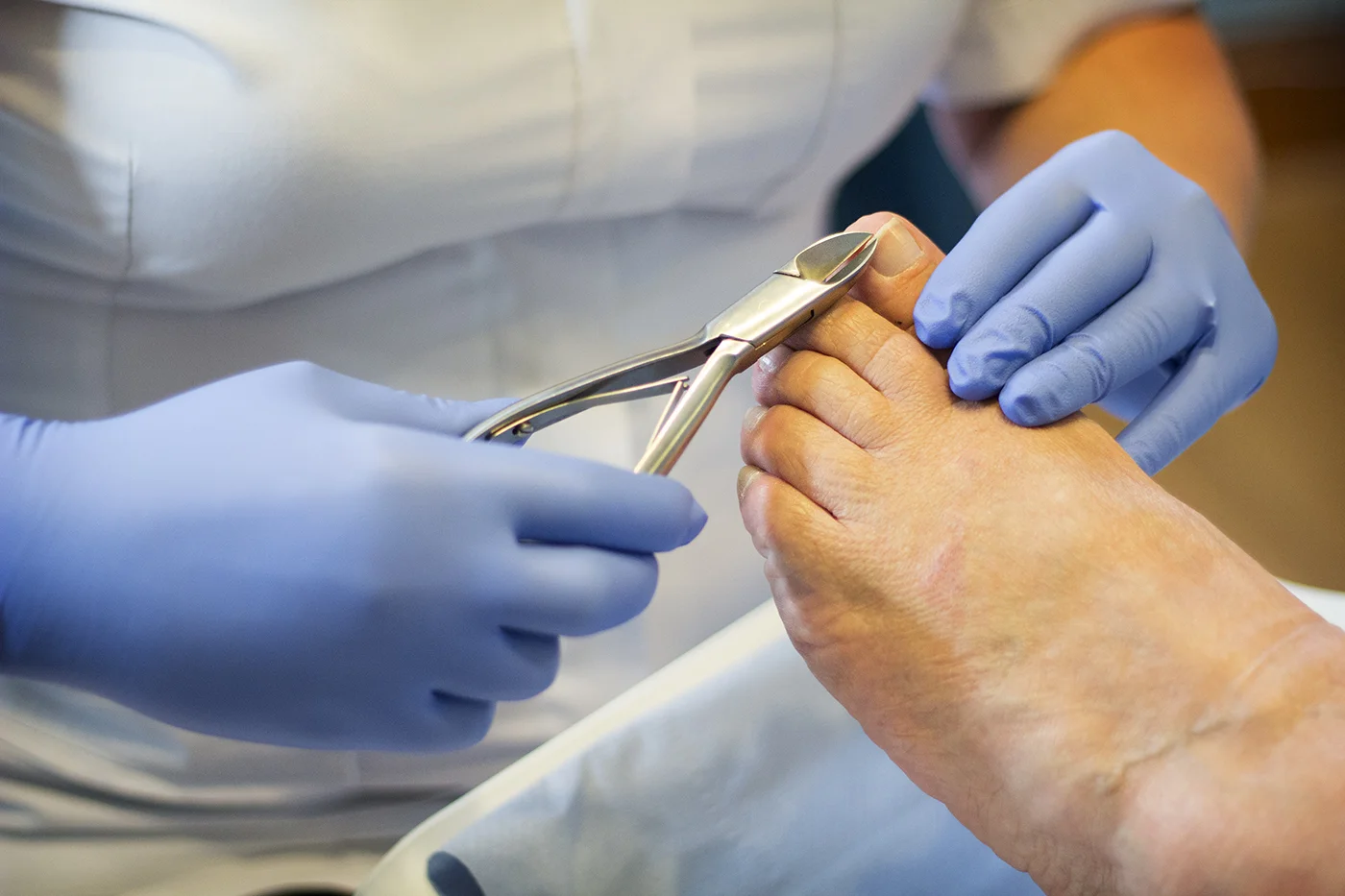 nippers cutting toenail.jpeg