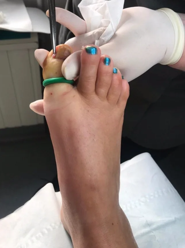 ALL aftercare included