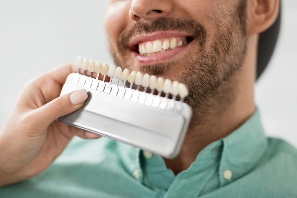 Teeth Whitening Solutions: Which Option Is Right For You?