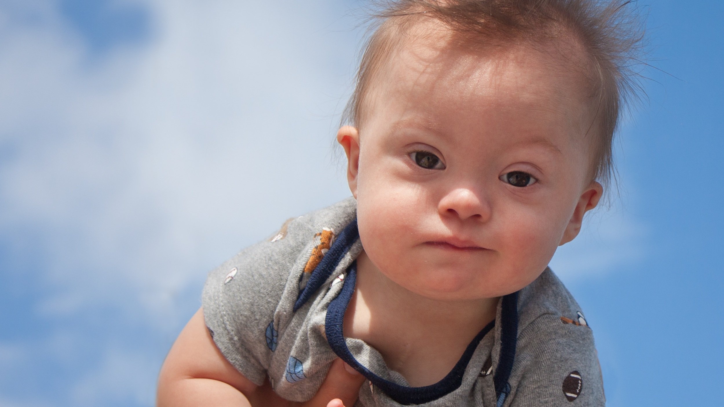 baby+with+Down%27s+syndrome.jpg