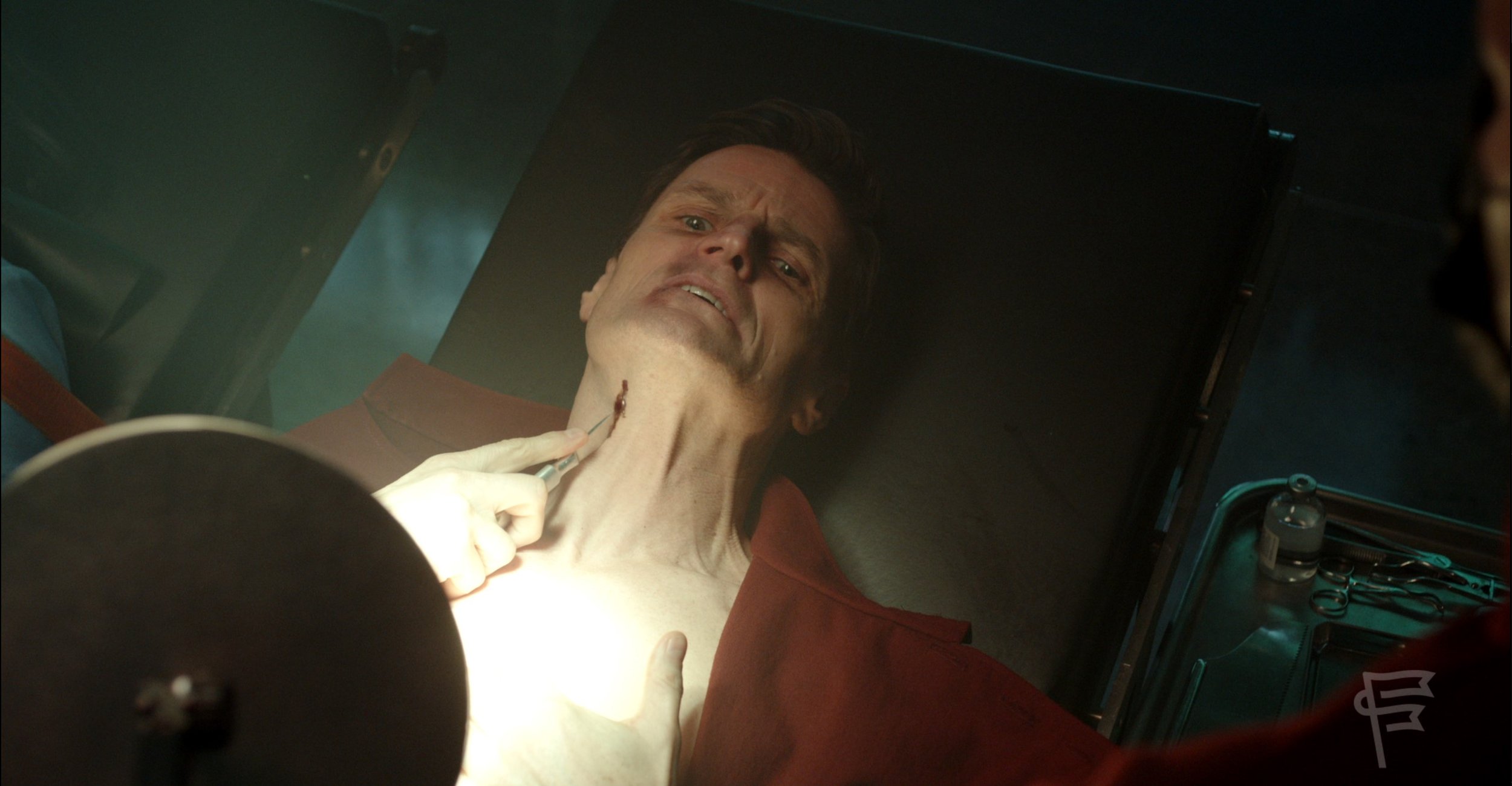 Peter_Braeley_MFSalem_03_wound_01_v001.jpg