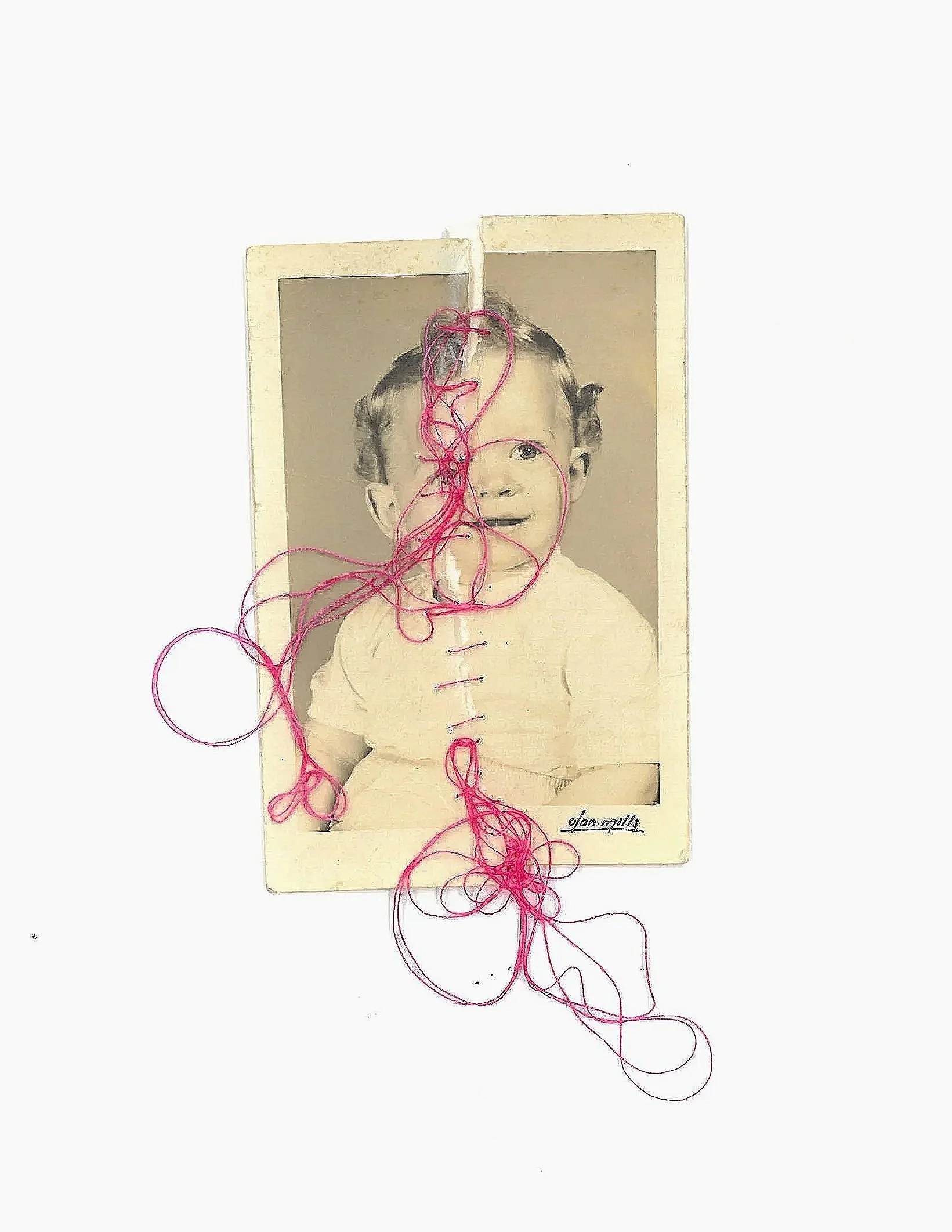 Mending Brain Fog