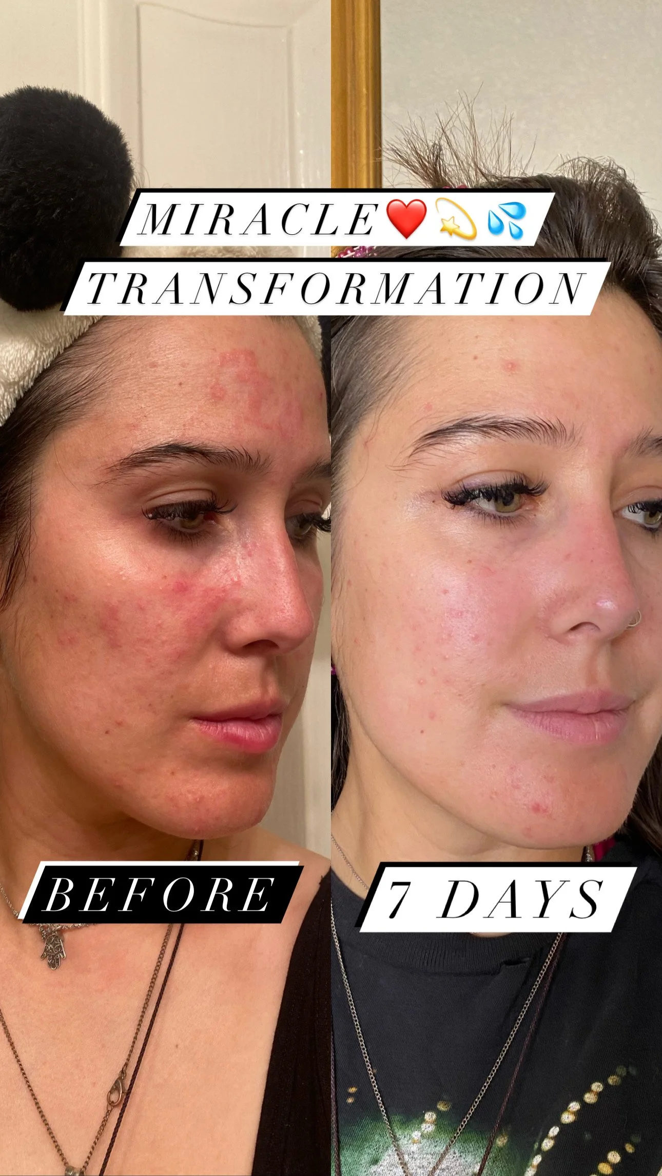 FEATURE PRODUCT - Copper Peptide Serum with 24K Gold