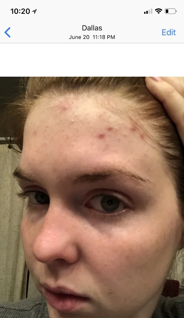 primally pure, primally pure everything spray review, toner that helps with breakouts, toner for acne prone skin, cruelty-free beauty, non-toxic skincare, lments of style, ellespann