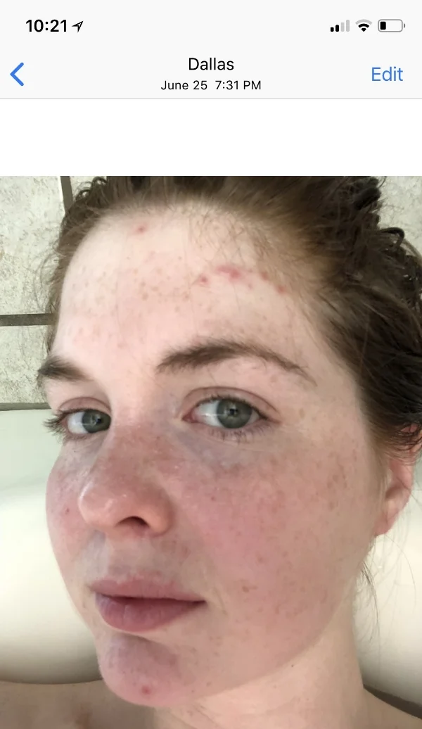 primally pure, primally pure everything spray review, toner that helps with breakouts, toner for acne prone skin, cruelty-free beauty, non-toxic skincare, lments of style, ellespann