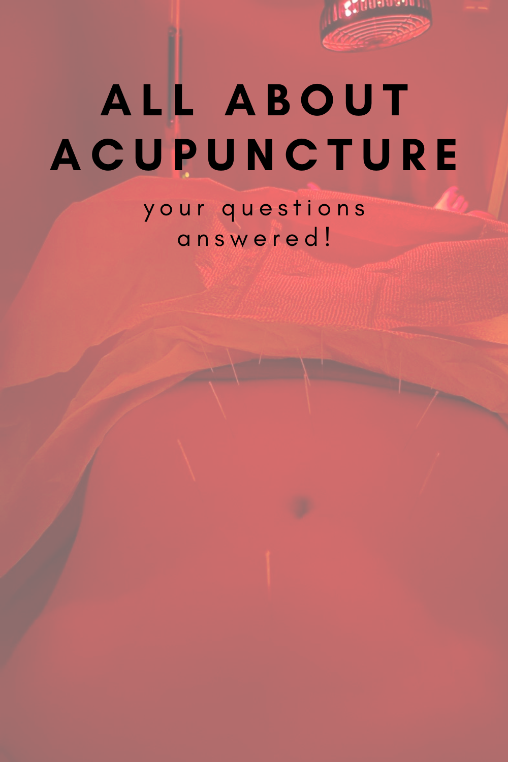 all about acupuncture, lments of style, la blogger, is it worth it, does acupuncture hurt, afraid of needles, balancing hormones, fertility, pcos, what to expect, cupping, insurance, Eastern Medicine, Chinese Medicine