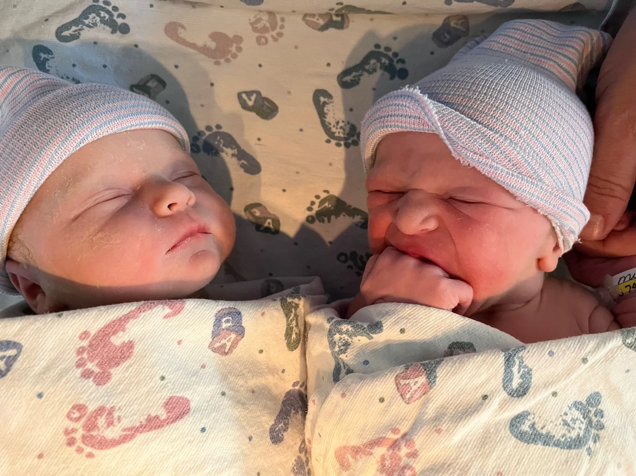C-Section with Twins: My Story, Recovery, and Tips