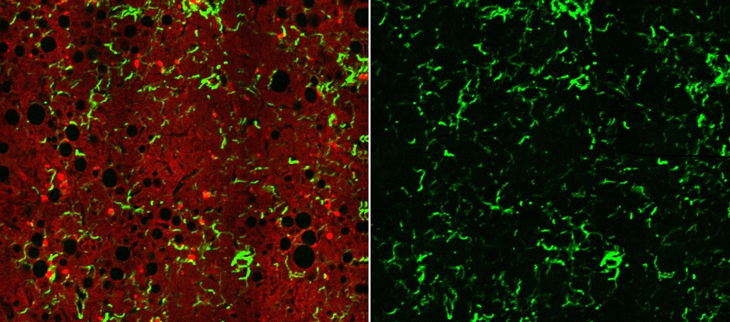 In Low Resolution for web: Left : NASH Liver Model shows collagen strings (green, SHG) overlapping the Fluorescence Signal from NADPH (cells). Right : the corresponding SHG / collagen image alone, that offers a great deal of information on the collagen content and structure, which is later quantified by our tools.