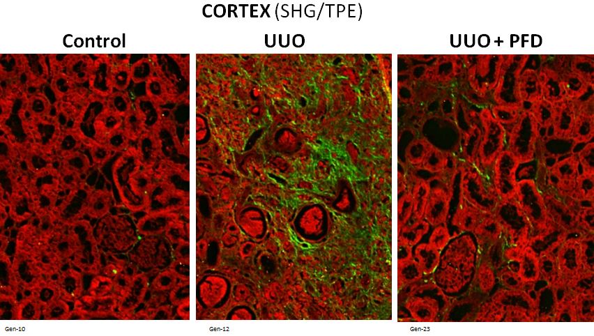 Above: SHG and 2PE imaging (20X) of the Cortex Region in a mouse UUO Model, at different Stages ( stdy describe above) Below: Corresponding SHG Image, showing the sensitivity and level of details of our imaging methods. Hypothesis-driven imaging tools can be applied to substantiate specific MOA.
