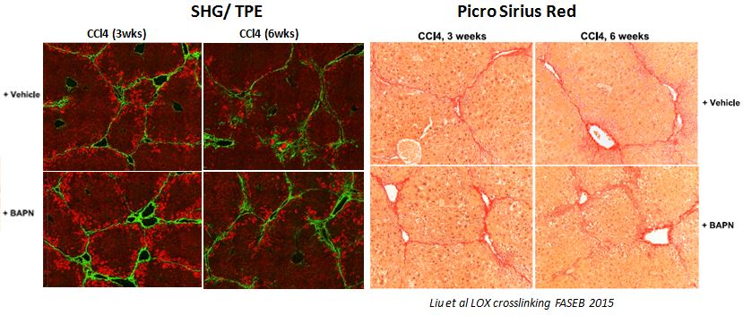 Side by side comparison of SHG & 2PE imaging of non-strained 5 micron FFPE slide with conventional PSR staining. Credits to Beth Israel Deaconess Medical Center, 2016.