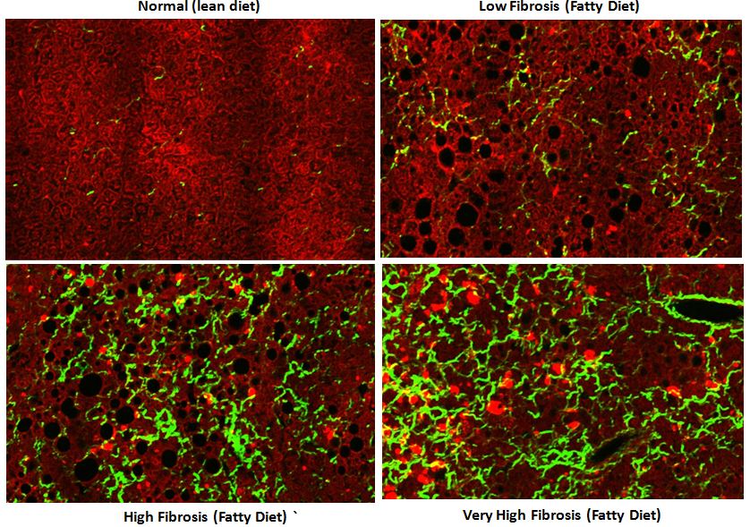 Rodent fed with Fatty Diet exhibit the development of fibrosis (in green, SHG imaging) and fat (dark circular vesicules on the 2PE red image) of increasing severity vs diet duration (above). Such images can be post-processed to extract a % Collagen Area (SHG image) and a % Fat Area % ( Extracted from the vesicules), showing good correlation with Hepatic Triglicerides (ref: W. Liang, 2015. PhD Dissertation, Establishment of a General NAFLD Scoring System for Rodents Models and Comparison to Human Liver Pathology - Chapter 2 - Link here )