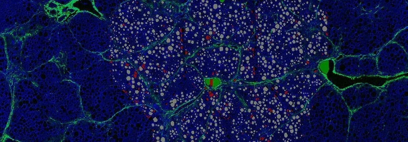 NASH treated Banner.jpg