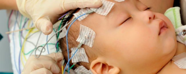 ELECTROENCEFALOGRAMA PARA NIÑOS