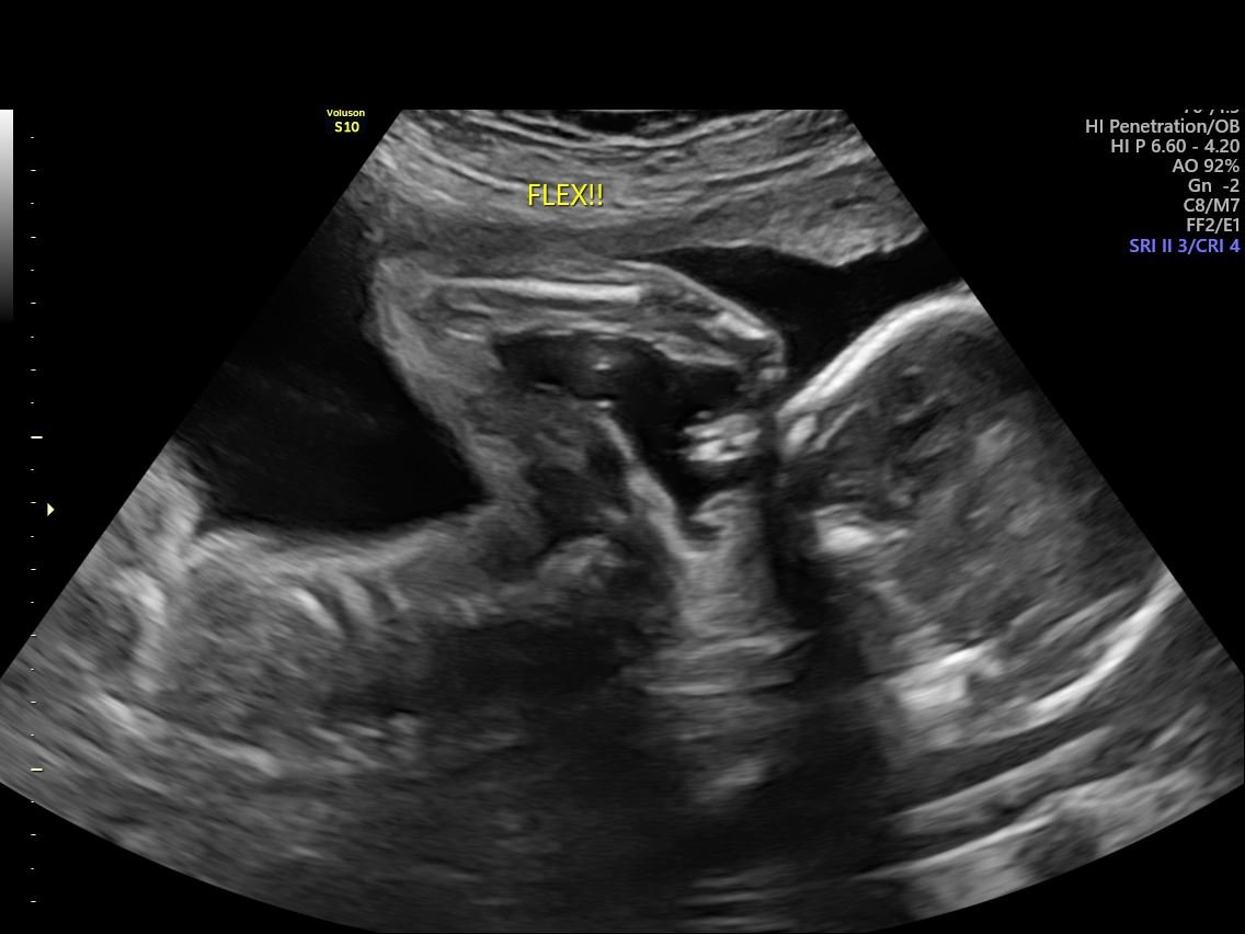 23 Weeks Pregnant | 4D Ultrasound + Bump Photos