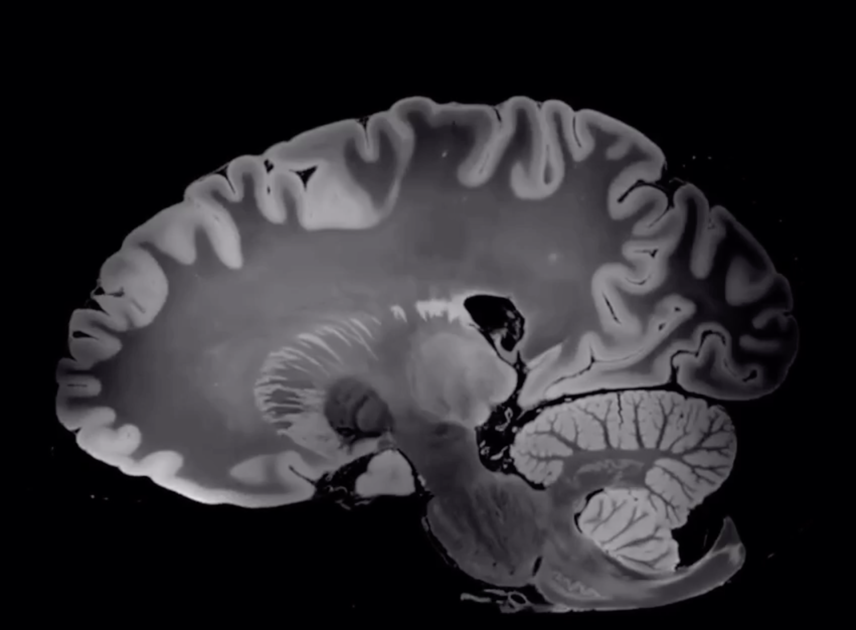 Insurances — Advanced NeuroSpine Pain Management and Neurology