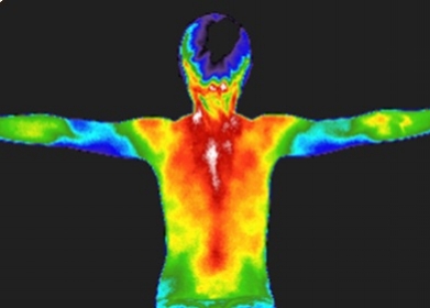 Thermography