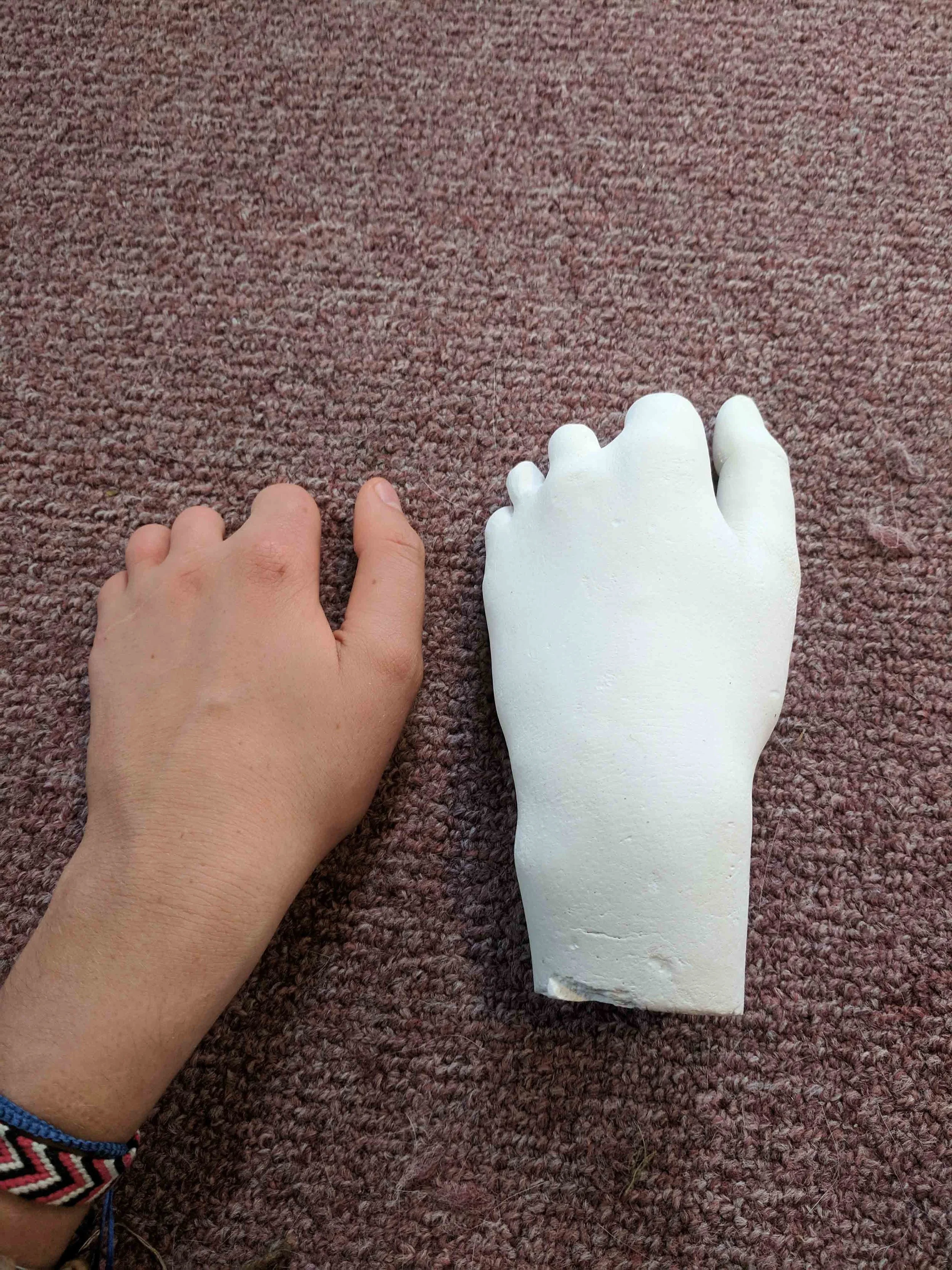 PLASTER CAST