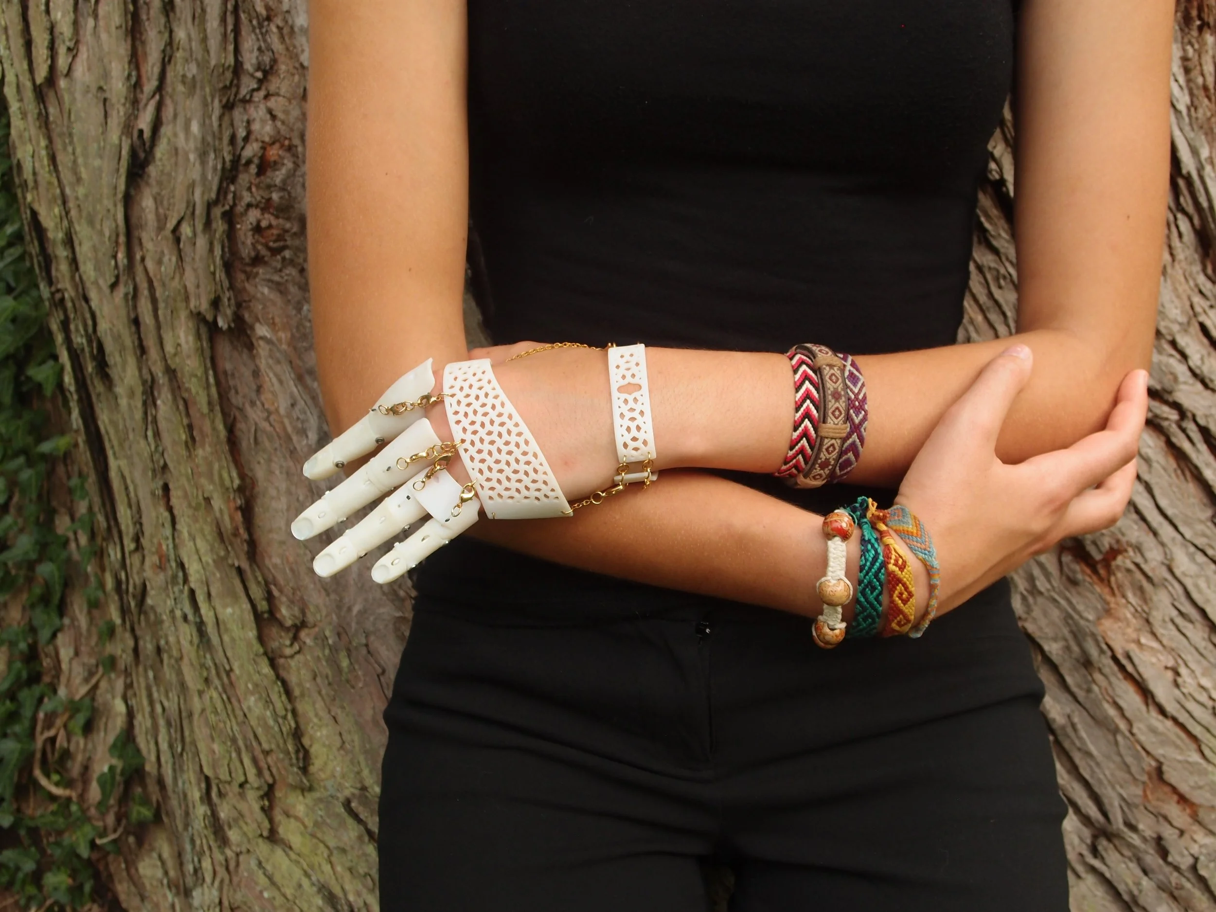 Digi-Rig Prosthetic Independent Study