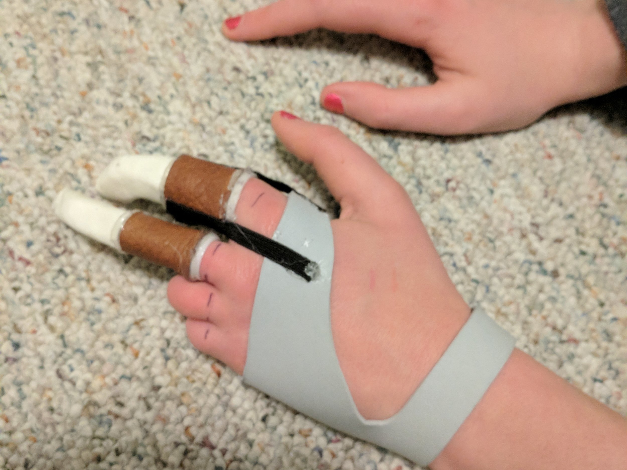 Digi-Rig Prosthetic Independent Study