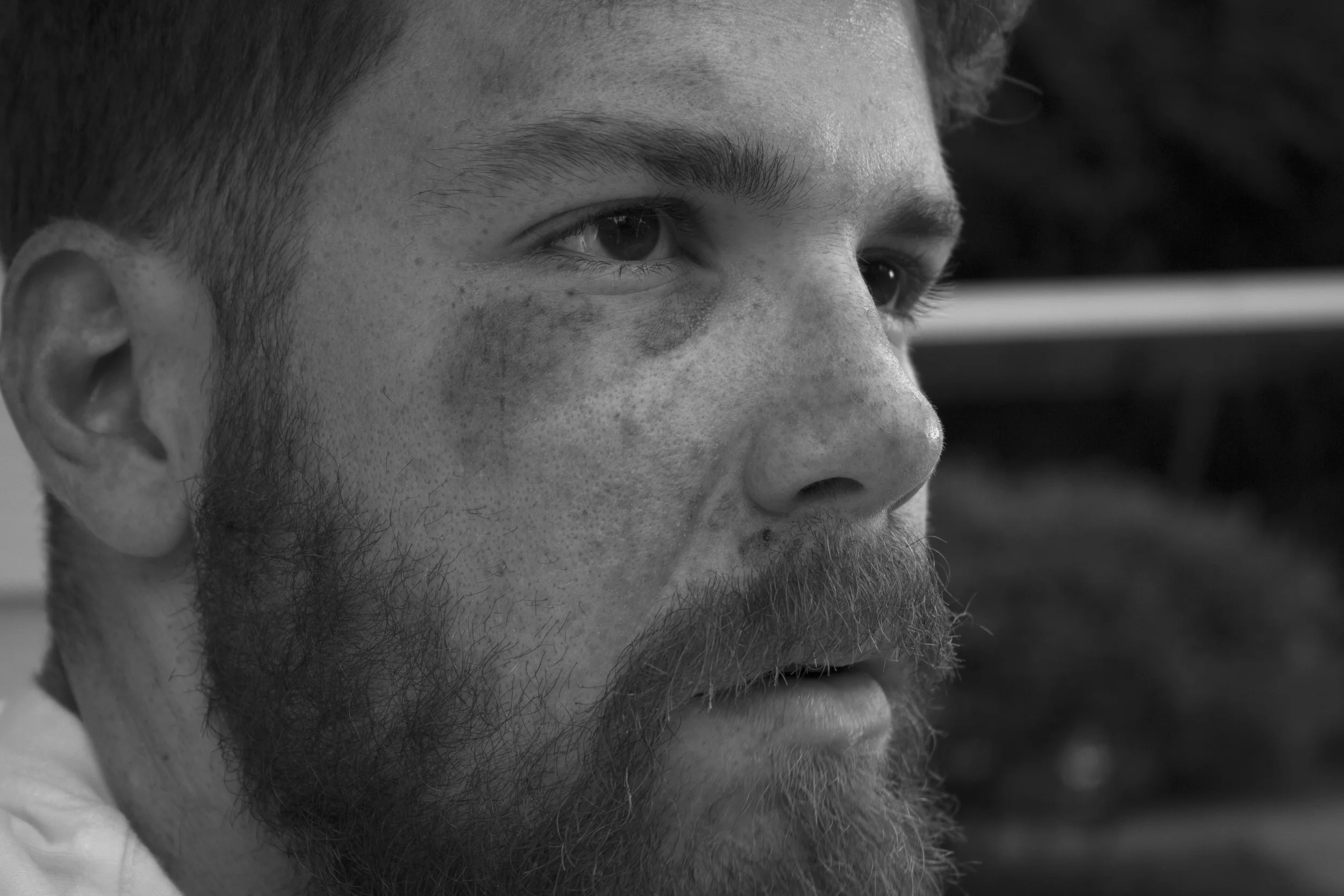 blackeye11.jpg