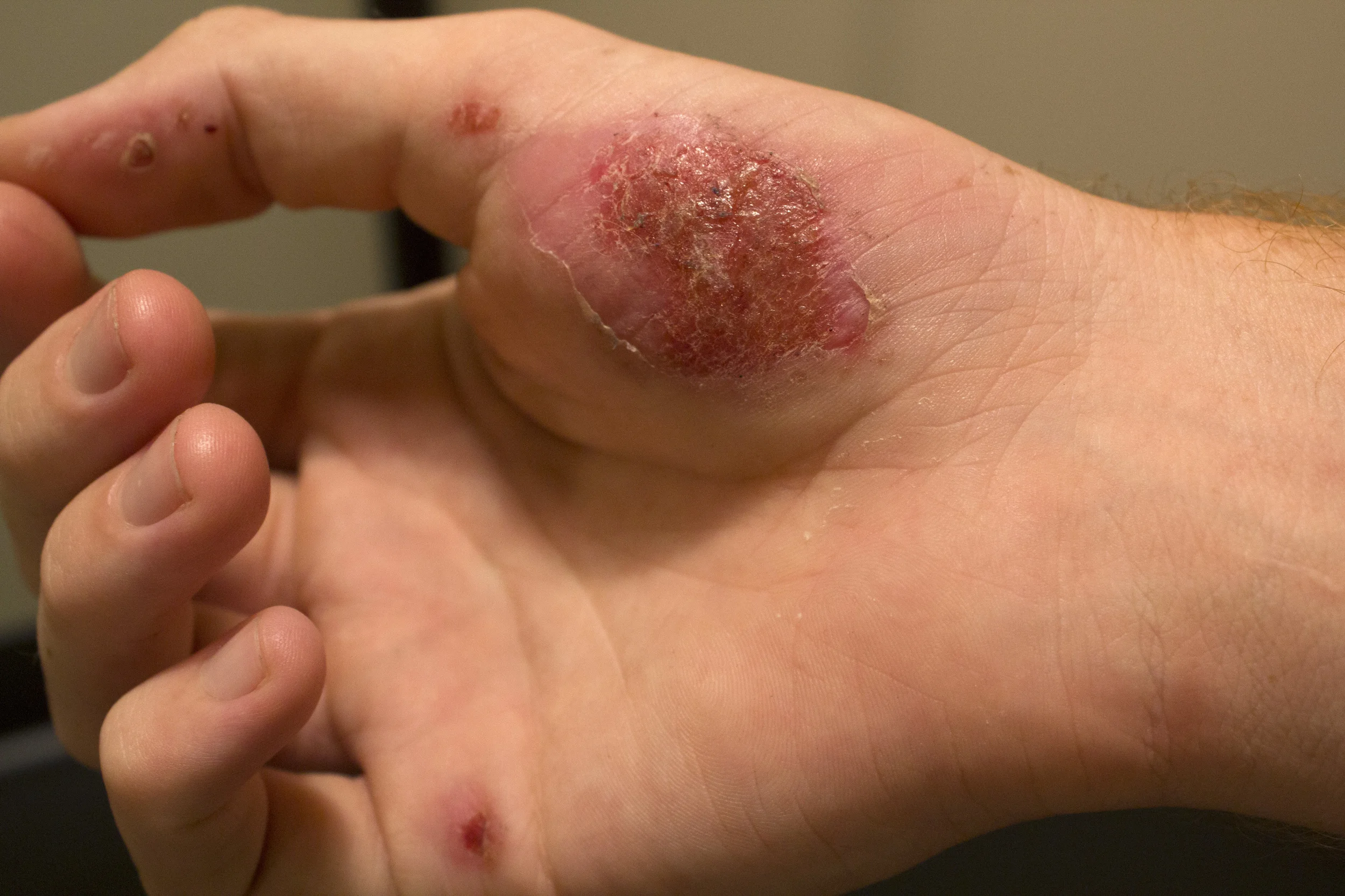 handscabs1.jpg