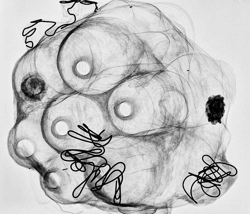 Sculpture X-ray 1, 2010