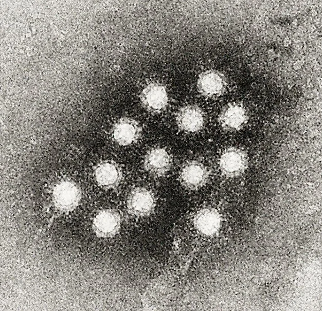 Hepatitis_A_virus_02.jpg