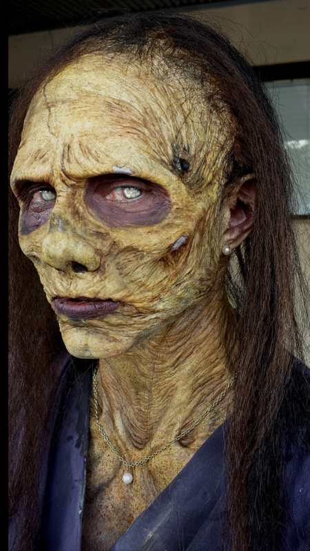 Prosthetic Application 