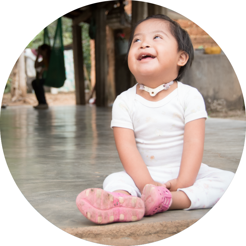 Derly received respiratory therapy and finally surgery to remove the tracheostomy tube she'd needed since birth