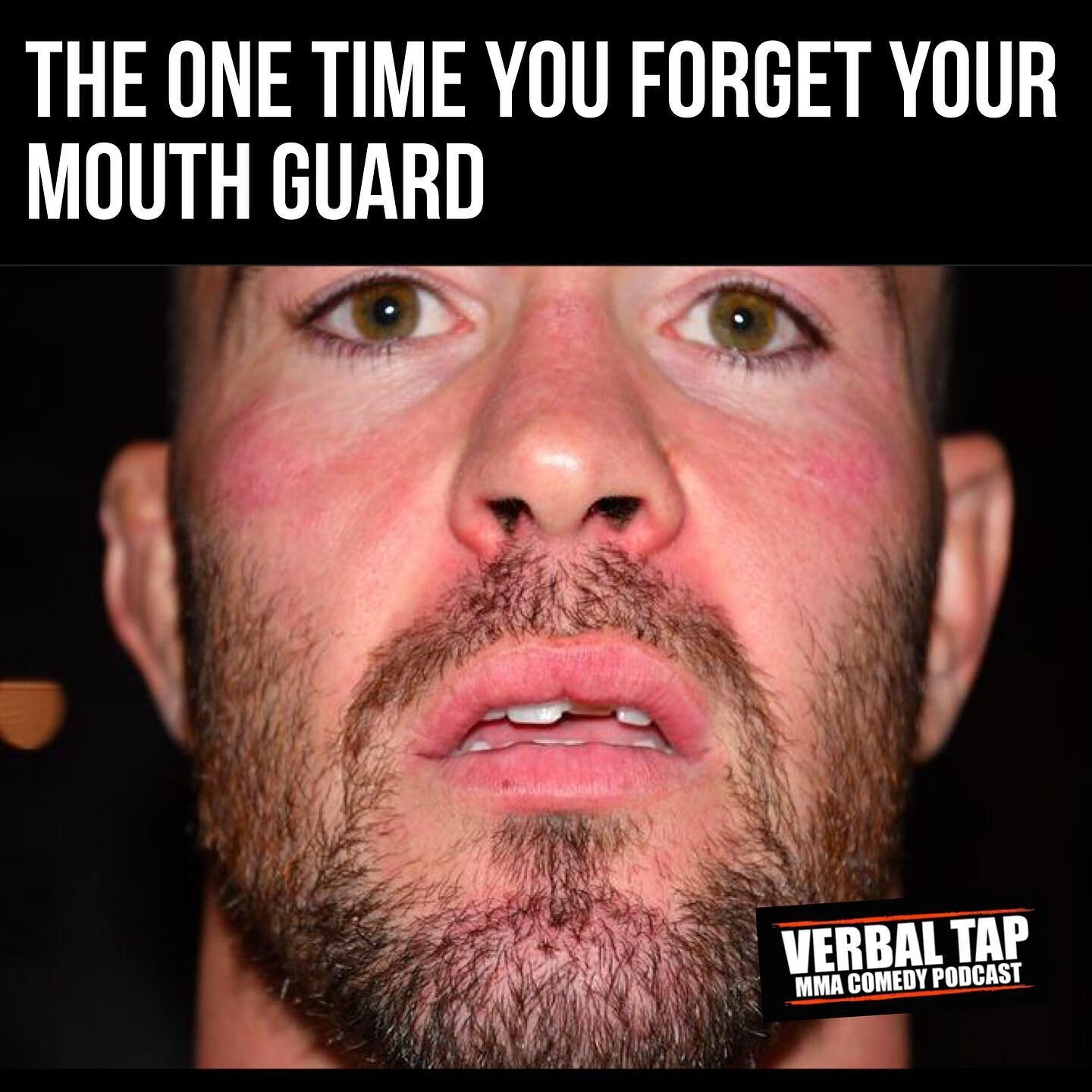 See this, this is your mouth with no mouthguard. 

Any questions?