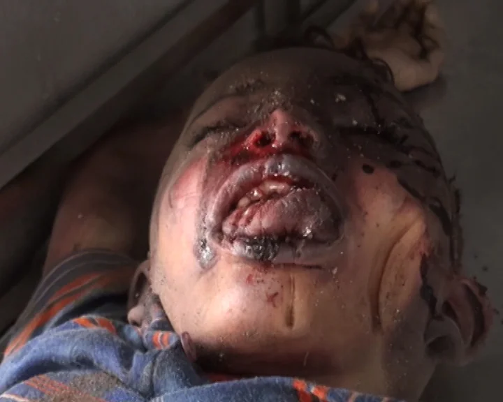 Child 5 - Ibb, Yemen - 13 April 2015.jpg