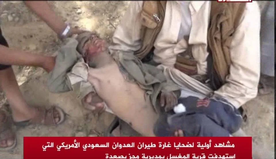 Child - Almaghsel Majez - Saada, Yemen - 4 June 2015.jpg